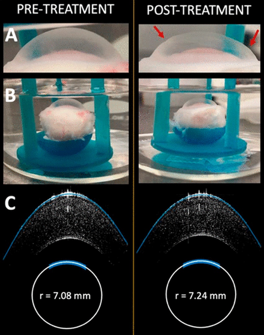 elektromechaniczne odkształcenie rogówki może poprawić wzrok. 